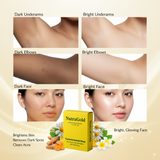 NutraGold Turmeric & 2 % Kojic Acid Soap